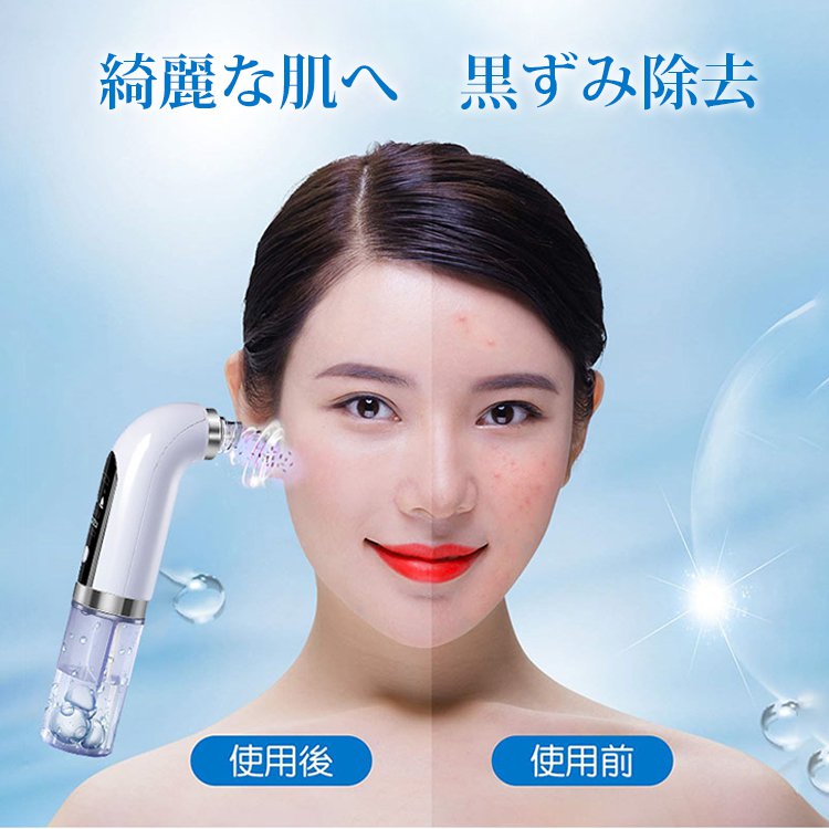 【エステ級   毛穴吸引器】ニキビ吸出し角栓除去 |  吸引しながら毛穴水循環洗浄 |  黒ずみ吸引 フェイスケア |   肌乾燥せず  |  ブルーライト除菌 毛穴ケア